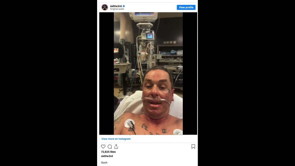 Slipknot's Sid Wilson Details Injuries Suffered In Explosion